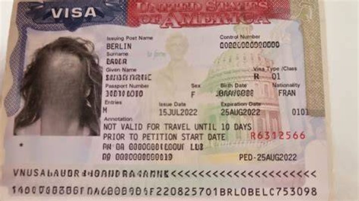 Are o1 visa holders resident aliens?
