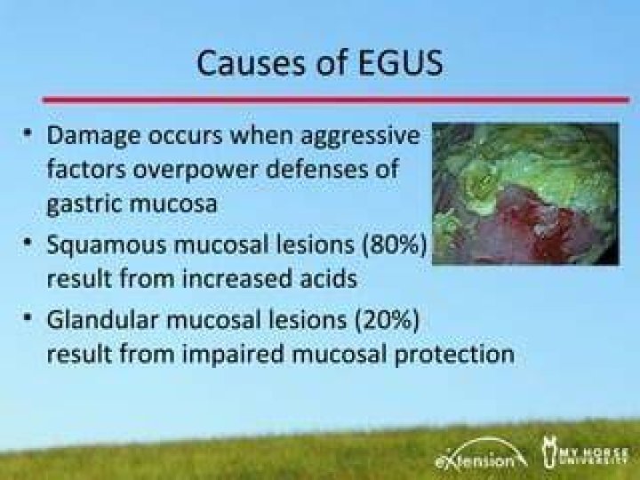 What causes EGUS?
